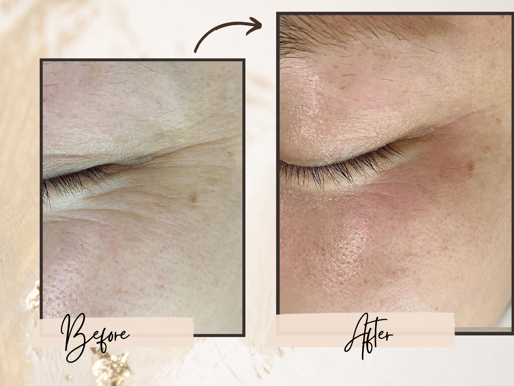 【たるみ・目のシワ】目元特化プレミアムケア￥19000→￥11900