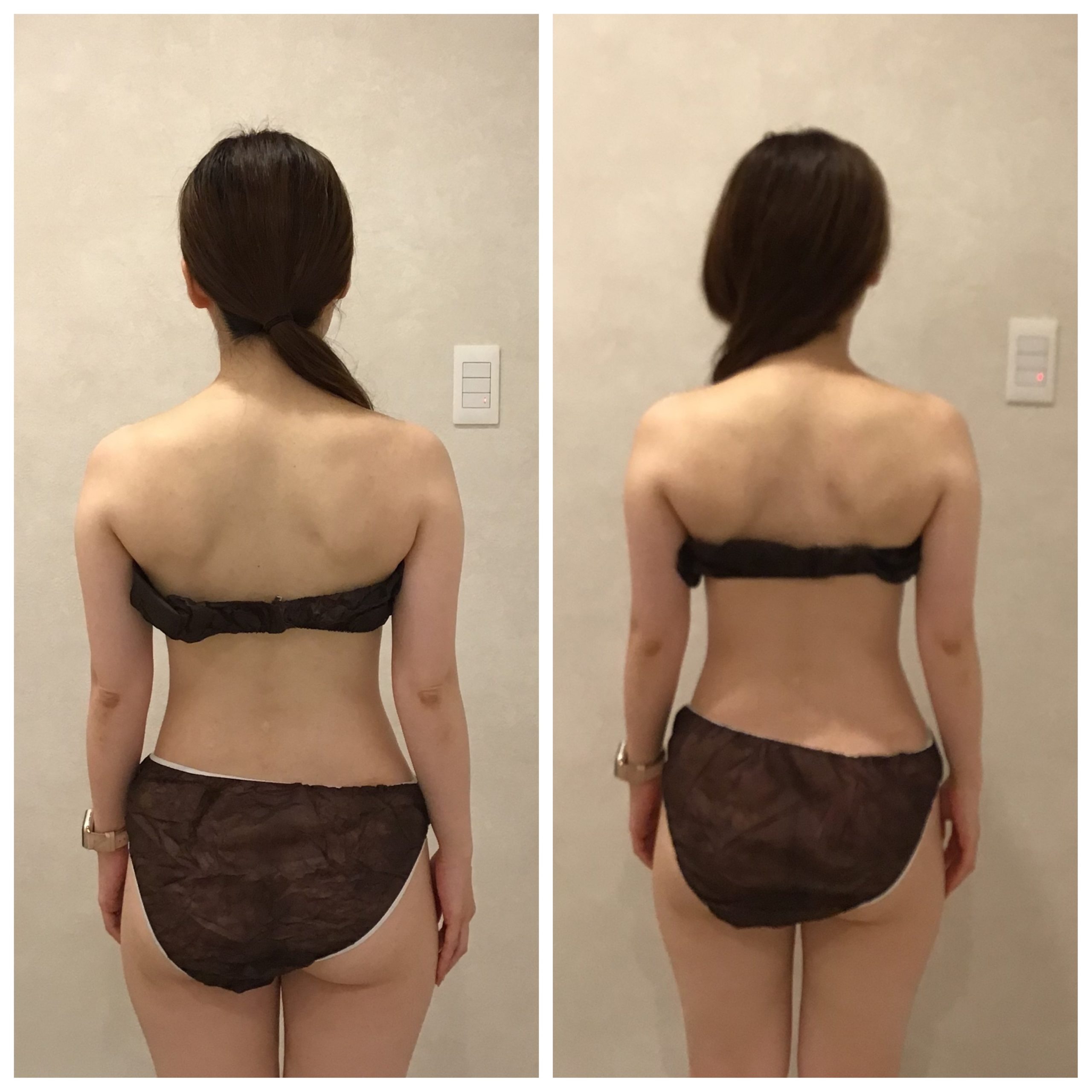 【駆け込みブライダルボディー】　背中集中☆肩甲骨はがし×脂肪分解導入